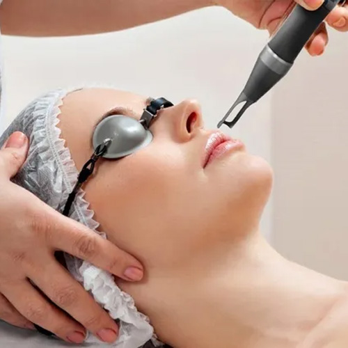 Laser Treatment